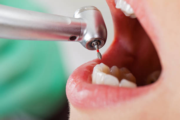 Best Emergency Dentist for Knocked-Out Tooth in Whitehorn Cove, OK